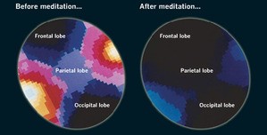 meditacion-cerebro