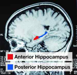 cerebro plástico